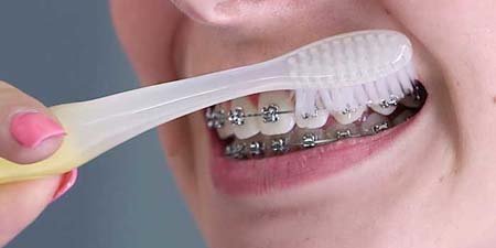 We advise electric brushes