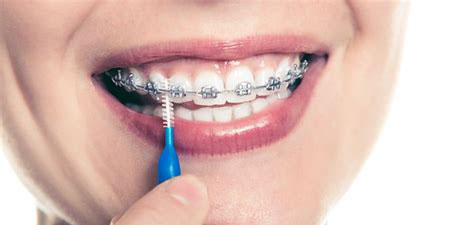 interdental brush